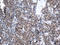 Cystatin B antibody, LS-C796502, Lifespan Biosciences, Immunohistochemistry paraffin image 