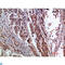 TFF1 antibody, LS-C813930, Lifespan Biosciences, Immunohistochemistry paraffin image 