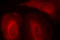 3-phosphoinositide-dependent protein kinase 1 antibody, LS-C336059, Lifespan Biosciences, Immunofluorescence image 