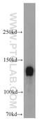 Mbs antibody, 22117-1-AP, Proteintech Group, Western Blot image 