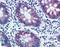 Anterior Gradient 2, Protein Disulphide Isomerase Family Member antibody, LS-B2011, Lifespan Biosciences, Immunohistochemistry paraffin image 