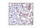 Cyclin D1 antibody, 2978, Cell Signaling Technology, Immunohistochemistry paraffin image 