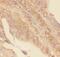 GLI Family Zinc Finger 1 antibody, PA5-79313, Invitrogen Antibodies, Immunohistochemistry frozen image 
