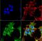 ATP Binding Cassette Subfamily C Member 8 antibody, NBP2-59320, Novus Biologicals, Immunofluorescence image 