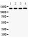 NLR Family Pyrin Domain Containing 3 antibody, LS-C343978, Lifespan Biosciences, Western Blot image 