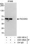 Protein Kinase C And Casein Kinase Substrate In Neurons 3 antibody, A301-981A, Bethyl Labs, Immunoprecipitation image 