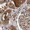 RAD23 Homolog B, Nucleotide Excision Repair Protein antibody, PA5-56236, Invitrogen Antibodies, Immunohistochemistry paraffin image 