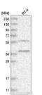 Rhomboid Like 1 antibody, PA5-65064, Invitrogen Antibodies, Western Blot image 