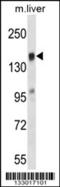 T Cell Lymphoma Invasion And Metastasis 2 antibody, 57-155, ProSci, Western Blot image 