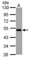 Meis Homeobox 2 antibody, PA5-30956, Invitrogen Antibodies, Western Blot image 