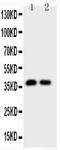 Calbindin 1 antibody, LS-C313438, Lifespan Biosciences, Western Blot image 