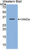 CD177 Molecule antibody, LS-C295622, Lifespan Biosciences, Western Blot image 