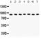 Ribosomal Protein S6 Kinase A5 antibody, PB9268, Boster Biological Technology, Western Blot image 