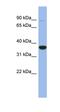 Dickkopf WNT Signaling Pathway Inhibitor 2 antibody, orb330796, Biorbyt, Western Blot image 