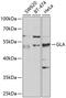 Galactosidase Alpha antibody, GTX32617, GeneTex, Western Blot image 