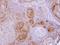 Gamma-Butyrobetaine Hydroxylase 1 antibody, NBP1-32327, Novus Biologicals, Immunohistochemistry frozen image 