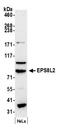 EPS8 Like 2 antibody, A301-842A, Bethyl Labs, Western Blot image 