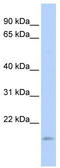 TNF Alpha Induced Protein 8 Like 1 antibody, TA338828, Origene, Western Blot image 