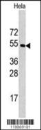 Carboxypeptidase E antibody, 63-109, ProSci, Western Blot image 