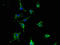 Transcobalamin 2 antibody, A63548-100, Epigentek, Immunofluorescence image 