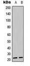 BCL2 Interacting Killer antibody, LS-C353908, Lifespan Biosciences, Western Blot image 