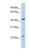 Branched Chain Keto Acid Dehydrogenase E1 Subunit Alpha antibody, NBP1-79616, Novus Biologicals, Western Blot image 