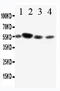 Fc Fragment Of IgA Receptor antibody, LS-C312703, Lifespan Biosciences, Western Blot image 