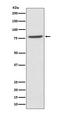 MRE11 Homolog, Double Strand Break Repair Nuclease antibody, M00731, Boster Biological Technology, Western Blot image 