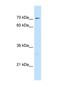 CTP Synthase 1 antibody, NBP1-52892, Novus Biologicals, Western Blot image 