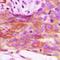 Lipase E, Hormone Sensitive Type antibody, orb214196, Biorbyt, Immunohistochemistry paraffin image 