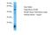 Cholinergic Receptor Nicotinic Alpha 6 Subunit antibody, A30009, Boster Biological Technology, Western Blot image 