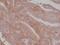 CD276 Molecule antibody, MA5-27898, Invitrogen Antibodies, Immunohistochemistry paraffin image 