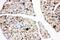 Insulin Like Growth Factor 1 Receptor antibody, PA5-79444, Invitrogen Antibodies, Immunohistochemistry paraffin image 