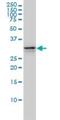 Ubiquitin Conjugating Enzyme E2 R2 antibody, H00054926-M01, Novus Biologicals, Western Blot image 