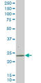 RAB43, Member RAS Oncogene Family antibody, LS-C133853, Lifespan Biosciences, Western Blot image 