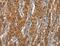 CD163 antibody, MBS2524363, MyBioSource, Immunohistochemistry paraffin image 