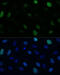 Kinesin Family Member C1 antibody, 19-028, ProSci, Immunofluorescence image 