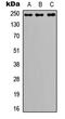 Notch Receptor 3 antibody, LS-C354448, Lifespan Biosciences, Western Blot image 