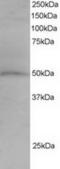 Sorting Nexin 5 antibody, TA302616, Origene, Western Blot image 