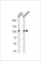 Mitogen-Activated Protein Kinase Kinase Kinase 21 antibody, 63-334, ProSci, Western Blot image 