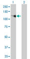Fibroblast Growth Factor Receptor 1 antibody, LS-C197216, Lifespan Biosciences, Western Blot image 