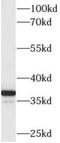 Aldo-Keto Reductase Family 1 Member C4 antibody, FNab00263, FineTest, Western Blot image 
