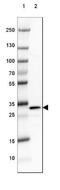 Protein Phosphatase 1 Regulatory Inhibitor Subunit 1B antibody, NBP2-33534, Novus Biologicals, Western Blot image 