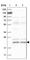 Chromosome 17 Open Reading Frame 49 antibody, HPA022961, Atlas Antibodies, Western Blot image 