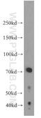 Lymphoid Restricted Membrane Protein antibody, 19498-1-AP, Proteintech Group, Western Blot image 
