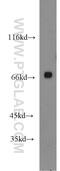 Glyceraldehyde-3-Phosphate Dehydrogenase, Spermatogenic antibody, 13937-1-AP, Proteintech Group, Western Blot image 