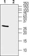 Potassium Voltage-Gated Channel Interacting Protein 2 antibody, PA5-77648, Invitrogen Antibodies, Western Blot image 