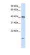 Transmembrane protein 79 antibody, NBP1-59832, Novus Biologicals, Western Blot image 