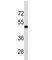 Transforming Growth Factor Beta Receptor 1 antibody, F52206-0.4ML, NSJ Bioreagents, Western Blot image 