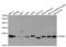 Proteasome Subunit Beta 4 antibody, TA332850, Origene, Western Blot image 